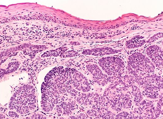 Kas ir histoloģija, un kam tā ir nepieciešama?