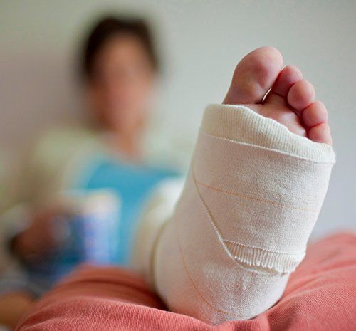 Woman with Plastered Leg — Plantation, FL — Law Offices of Jason T. Corsover