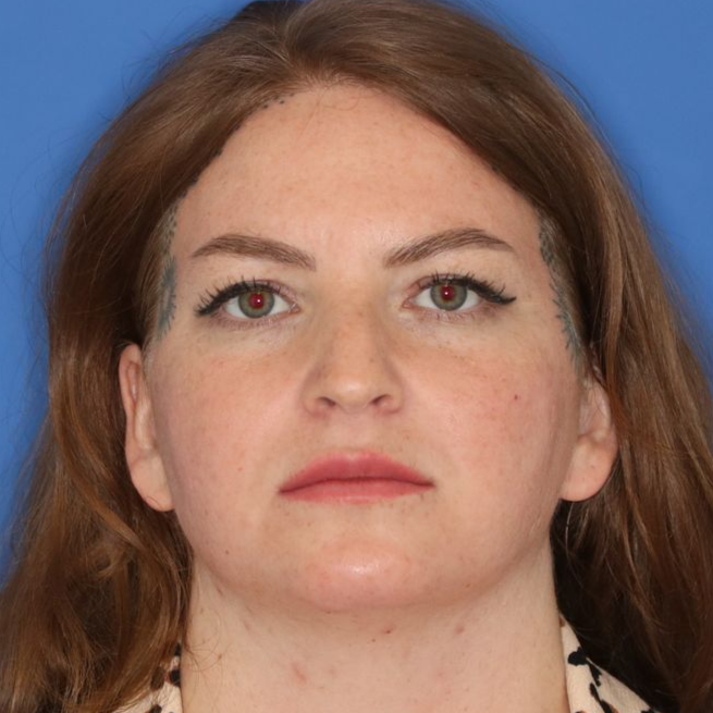 Woman posing on a blue background facing the camera for a before photo