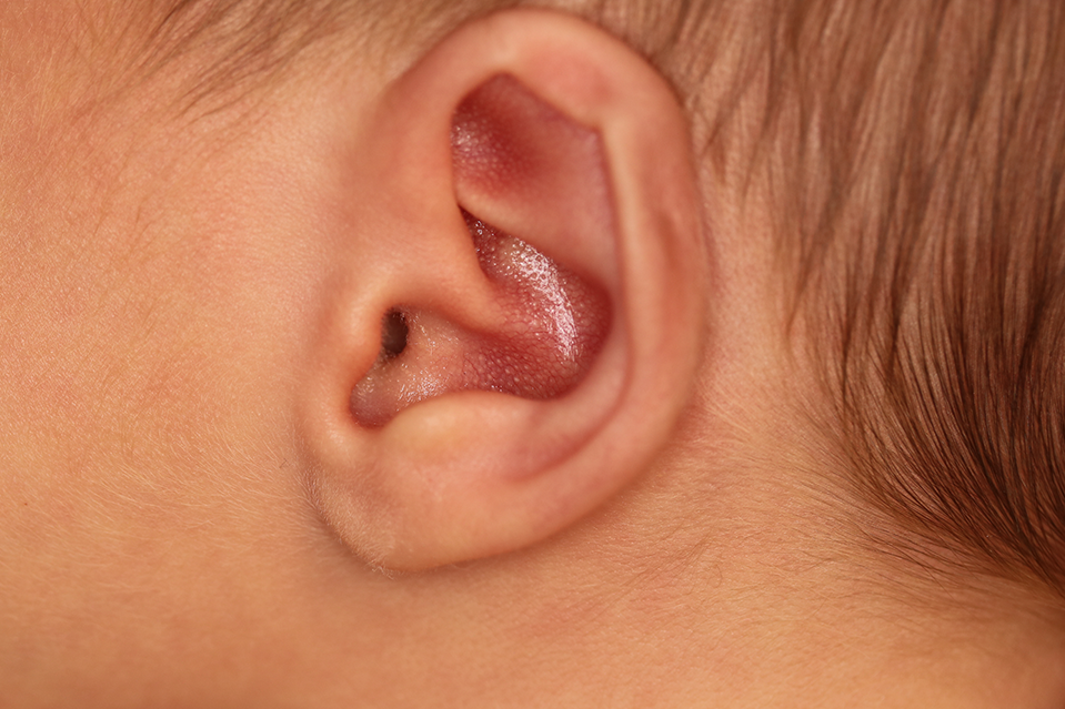 Close up of an infant's ear before EarWell Infant Ear Molding at Carson Williams Facial Plastic Surgery in Leawood, KS