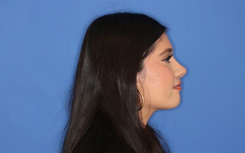 A close up of a woman 's lips and nose.