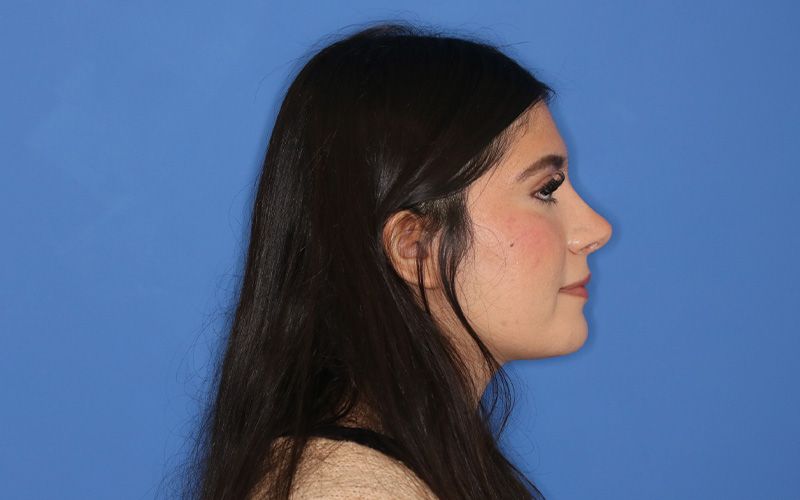 A close up of a woman 's lips and nose.