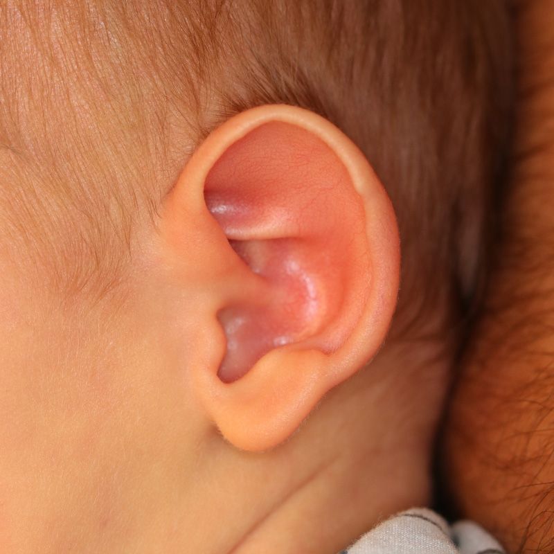 Close up of an infant's ear after EarWell Infant Ear Molding at Carson Williams Facial Plastic Surgery in Leawood, KS