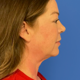 43 year old female in front of a blue background