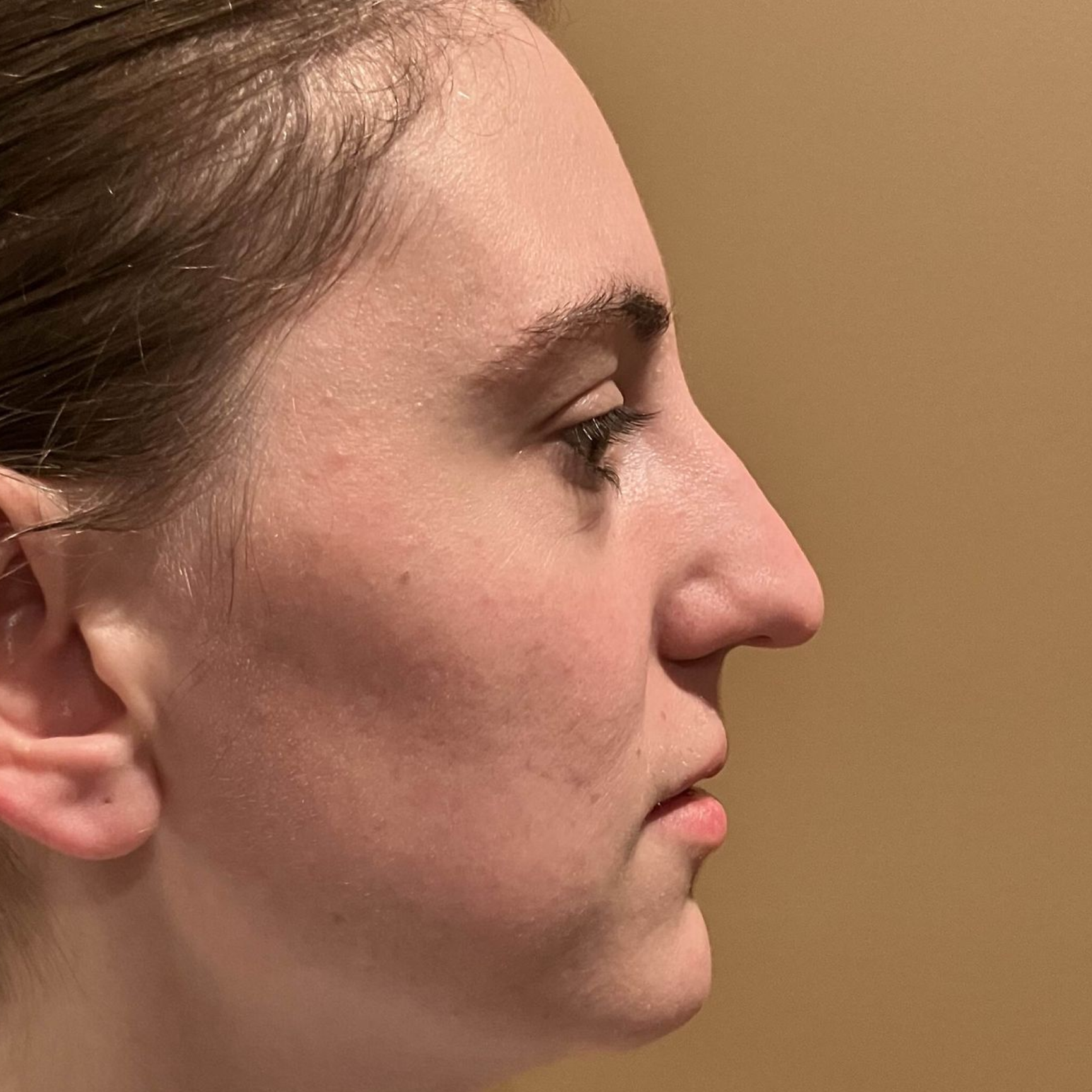 Woman posing on a tan background before receiving a rhinoplasty
