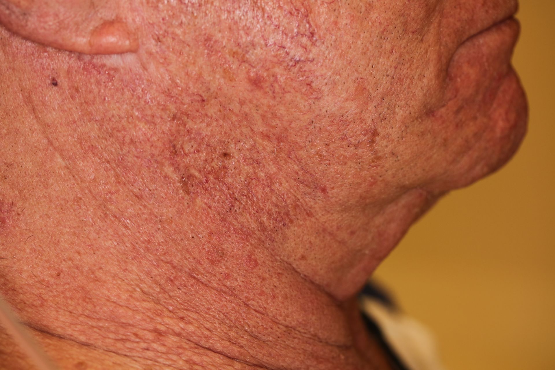 A close up of an older man 's neck and face.