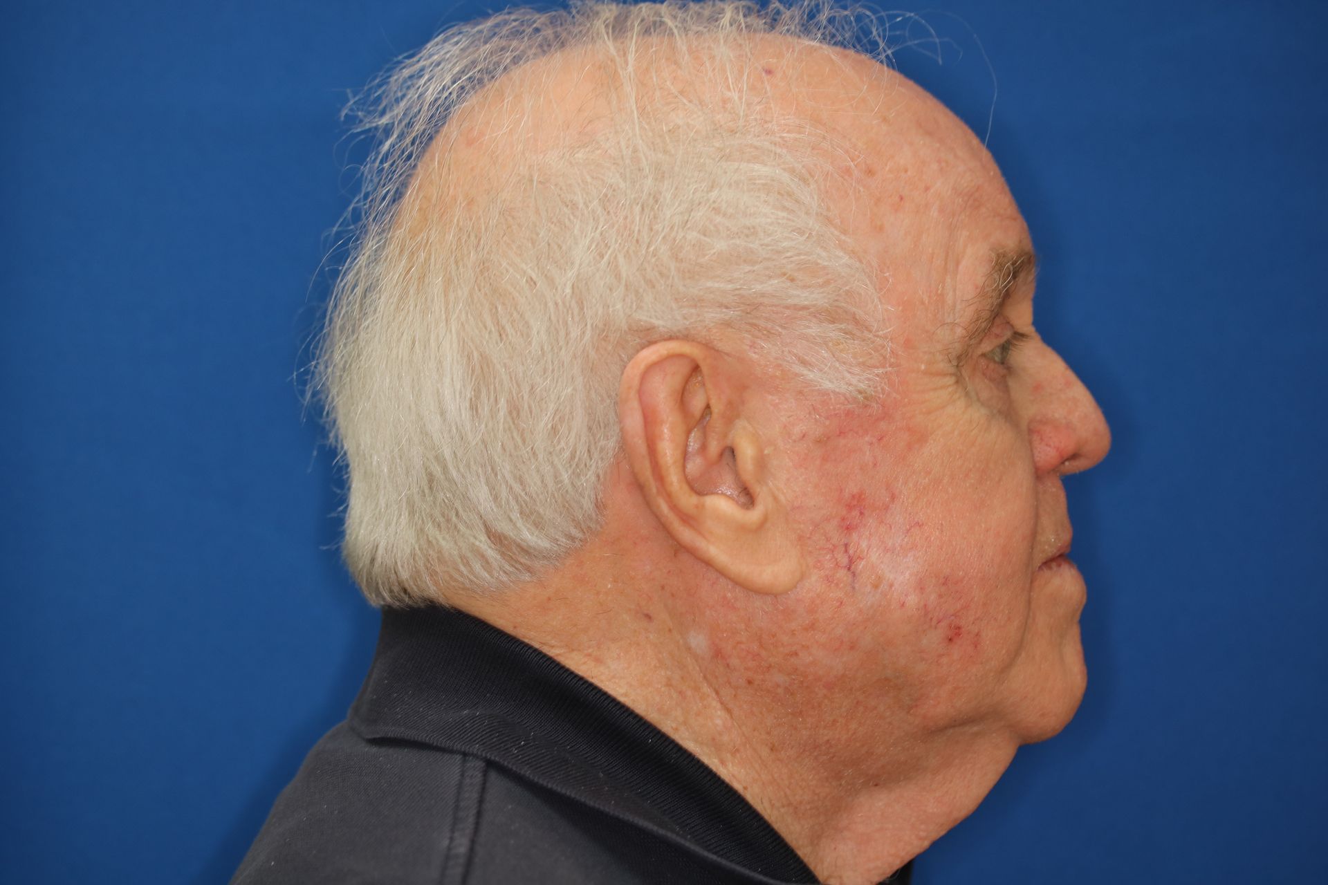 A man with white hair and a black shirt is standing in front of a blue background.