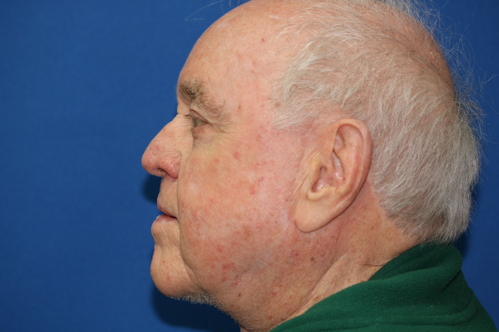 The man is wearing a green shirt and has a beard.