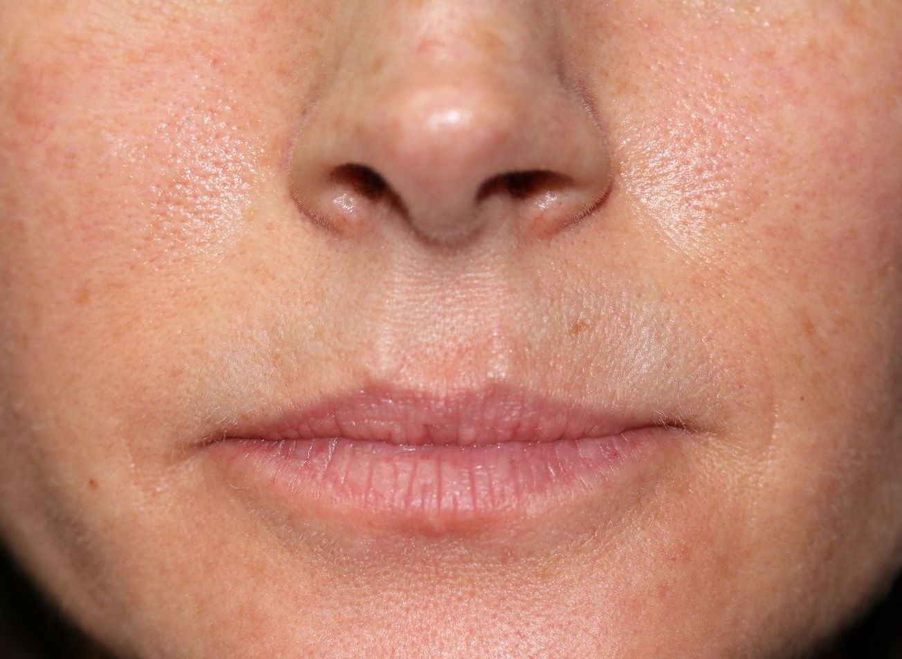 A close up of a woman 's face with a nose and lips.