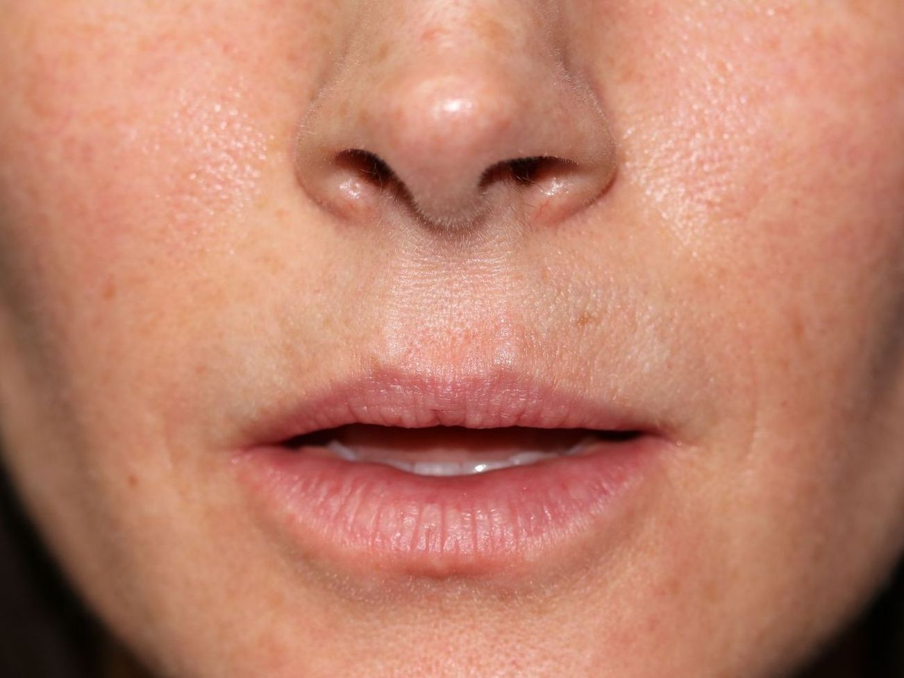 A close up of a woman 's lips and nose.