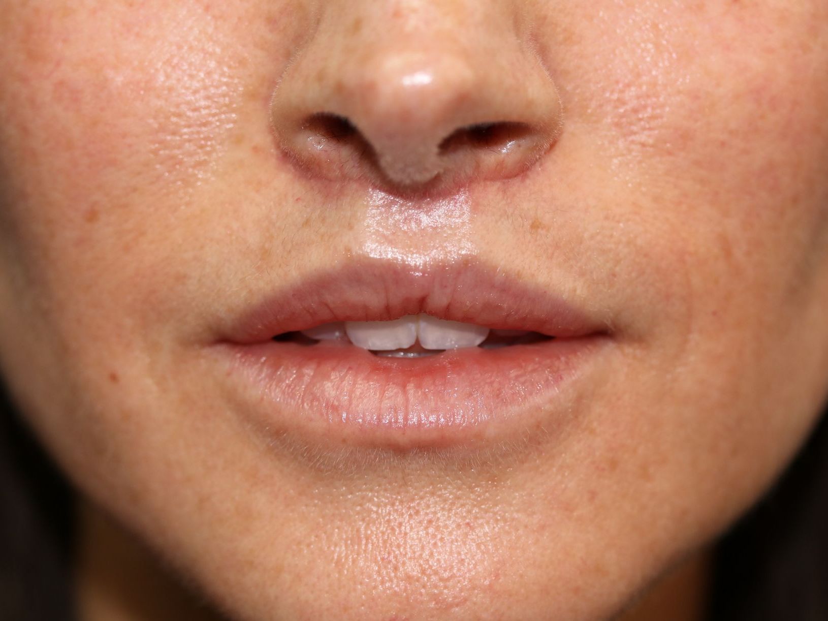 A close up of a woman 's lips and nose.