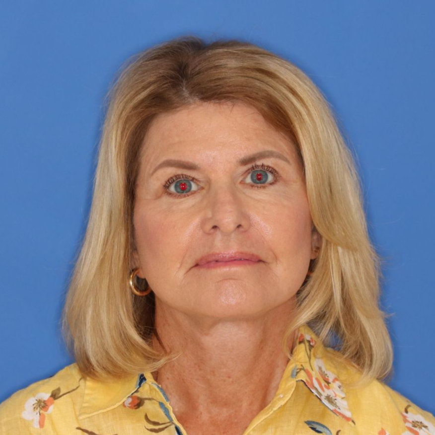 71 year old female posing on a blue background for an after photo