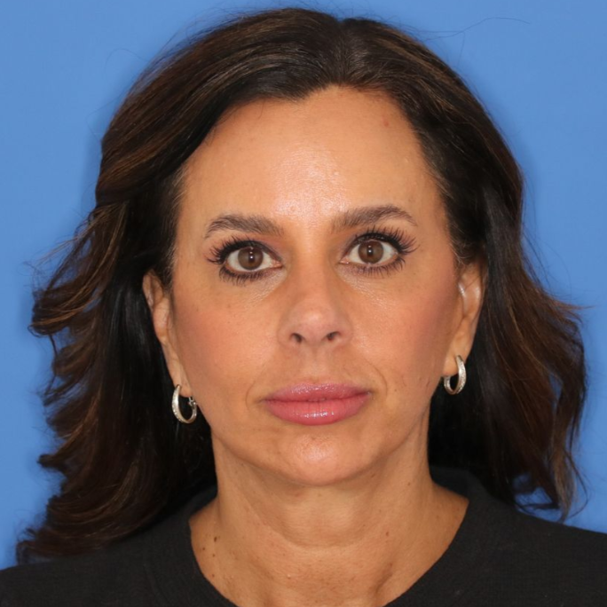 51 year old female posing for an after photo on a blue background
