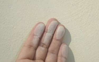 Hand with white substance on fingertips. Fingers are partially closed against a beige background.