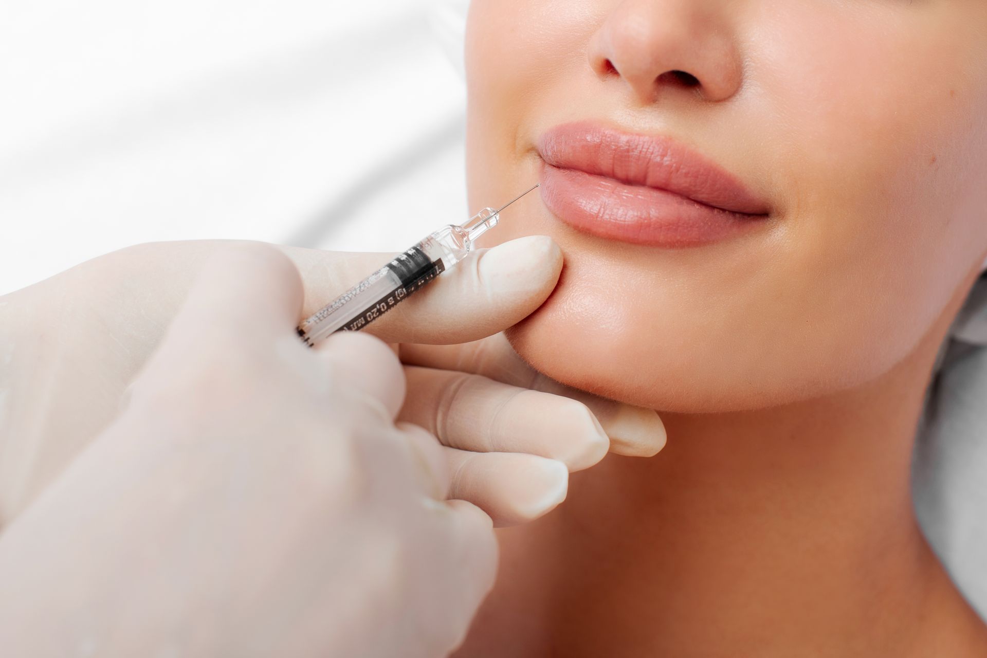 Person receiving lip filler injection with a syringe.