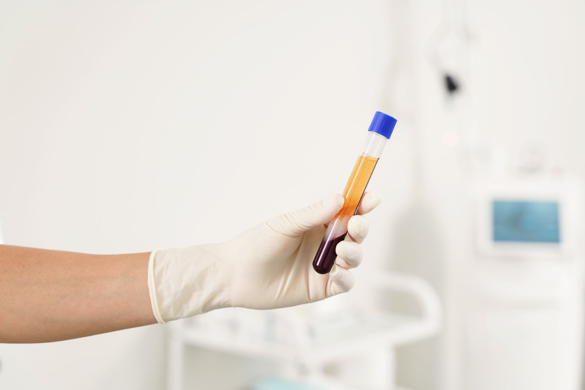 A gloved hand holds a blood sample tube showing distinct separated layers of clear yellow plasma and red blood cells.