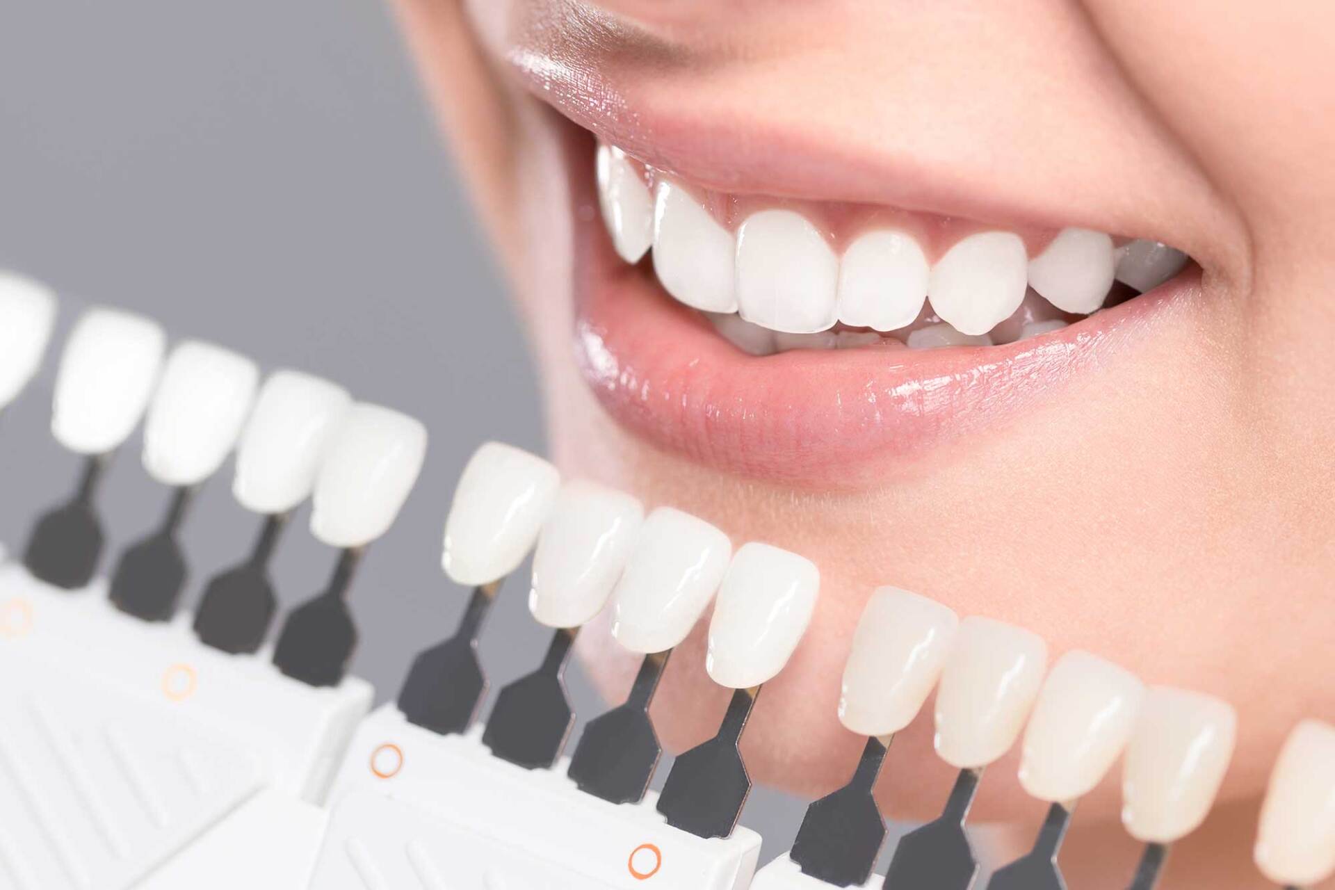 Beautiful Smile and White Teeth of a Young Woman — Sylacauga, AL — O'Brien Family Dentistry