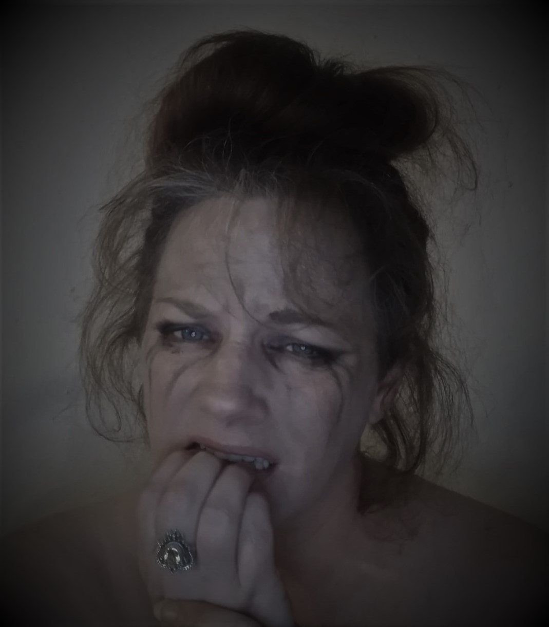 A woman with a ring on her finger is biting her nails, representing despair.