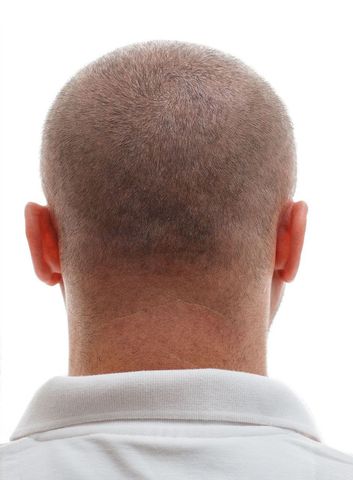 the back of a man 's head with a white shirt on