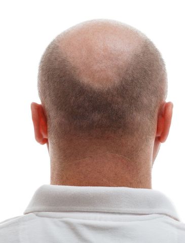 the back of a bald man 's head with a white shirt on