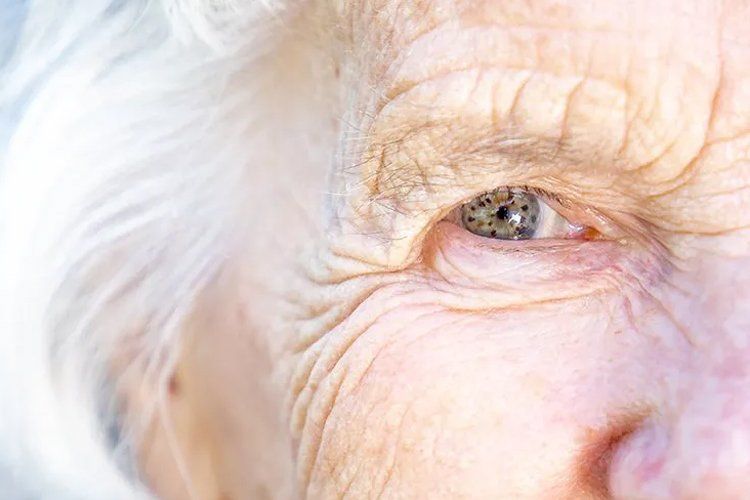Age-Related Macular Degeneration
