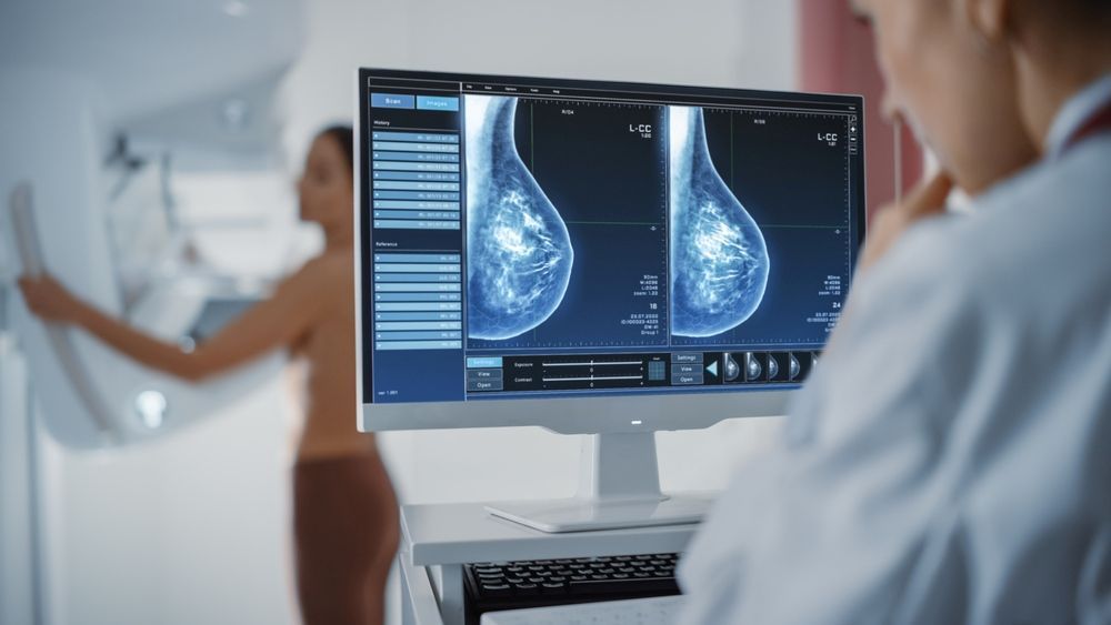 A Doctor is Looking at a Breast Scan on a Computer Screen — One Stop Medical in Mackay, QLD