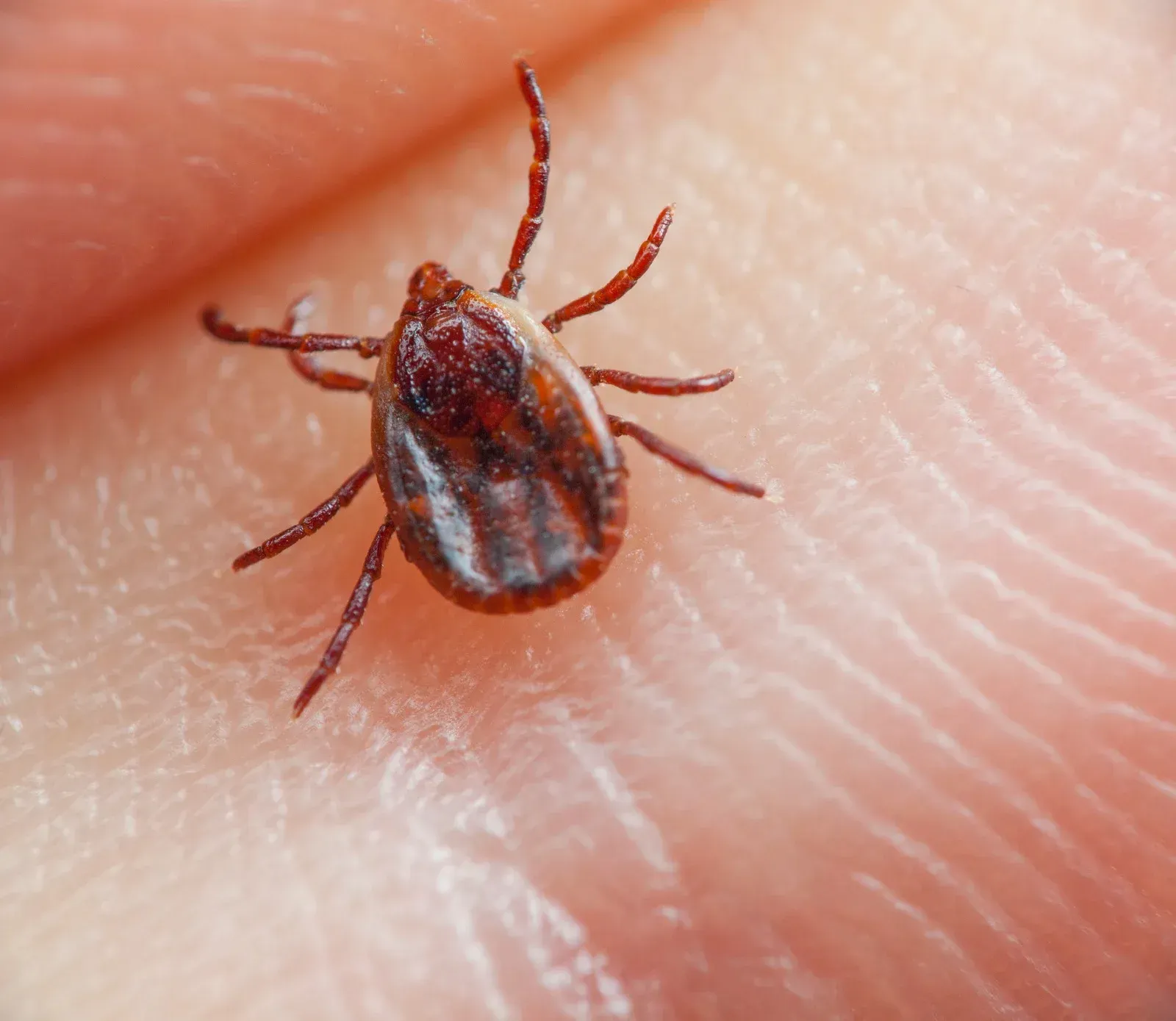 Tick on human skin, reddish-brown, with eight legs.