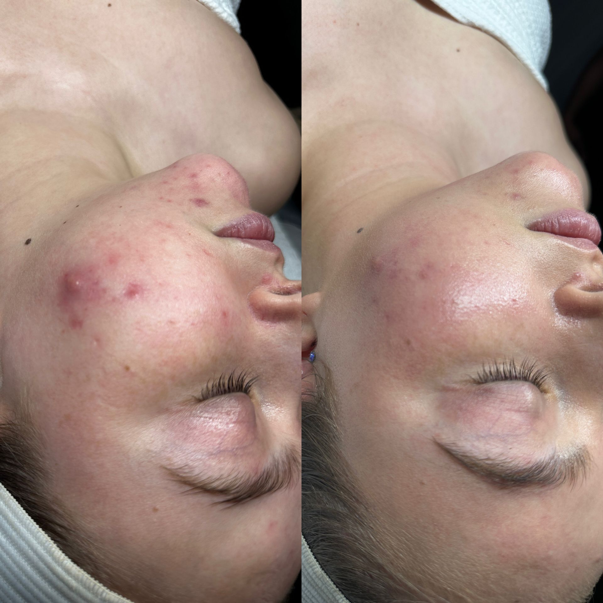 a woman with before and after a treatment