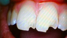 Clearwater Dentist in Clearwater FL | Office of Dr. Nadia