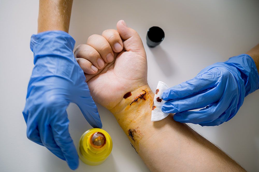 Two gloved hands treating a bleeding wrist wound with a cotton pad and topical medicine.