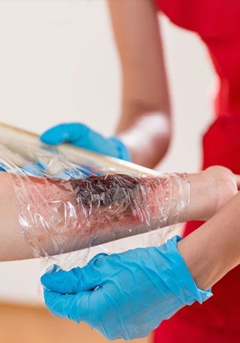 Person wraps plastic wrap around a burn on a forearm, wearing blue gloves and a red top.
