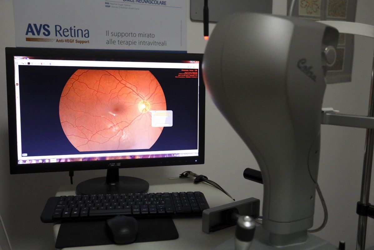 Un monitor di computer con l'immagine di un occhio su di esso