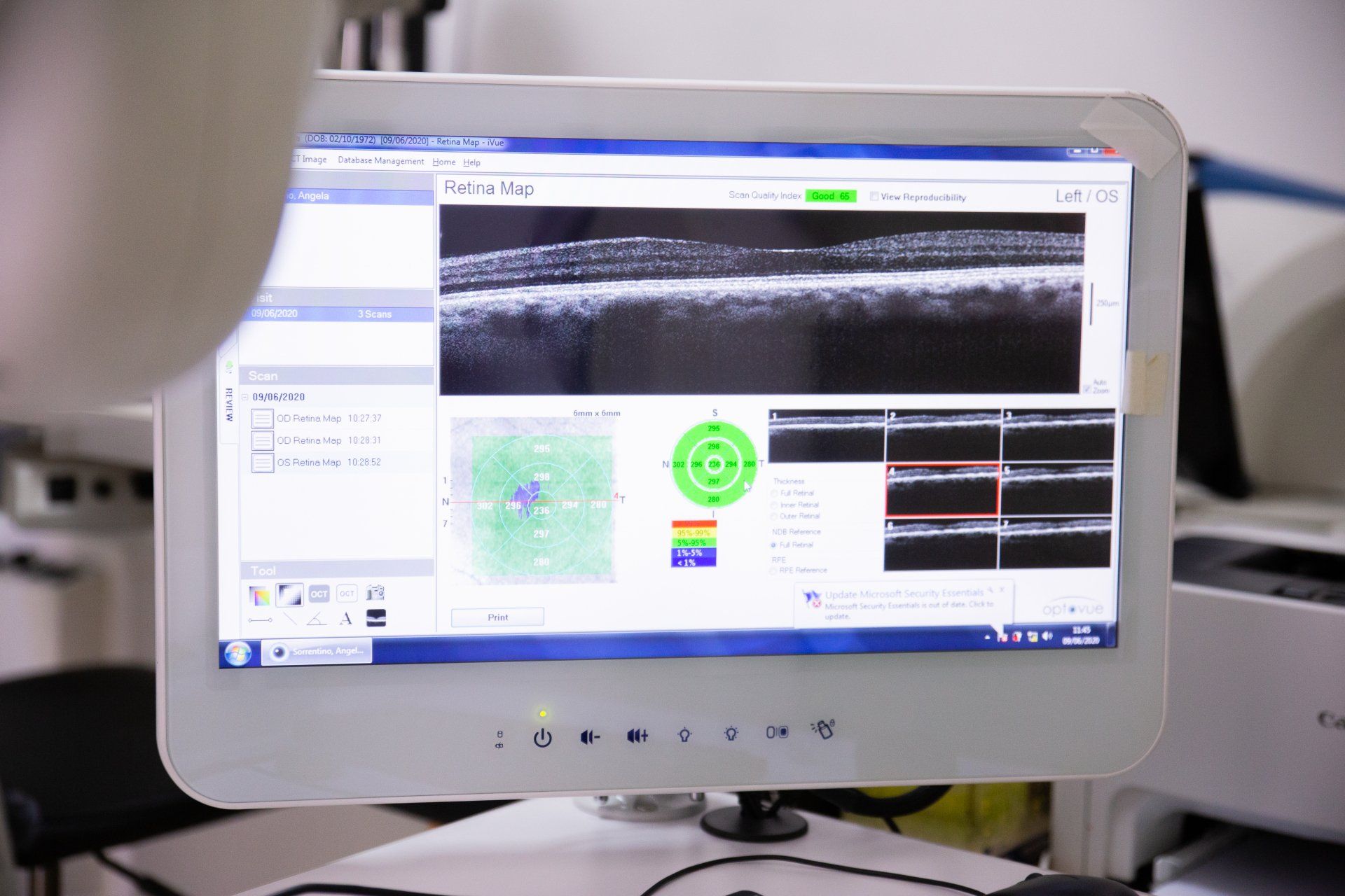 Un monitor di computer mostra l'immagine dell'occhio di una persona