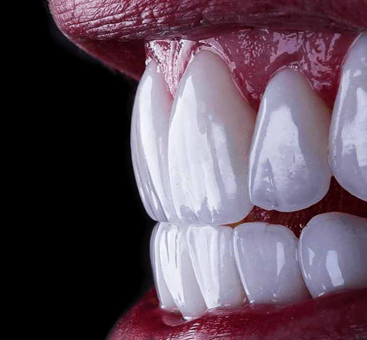 dentista mentre mostra delle protesi dentali