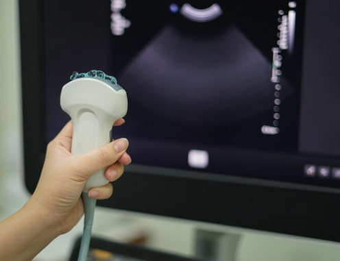 Ultrassom com Doppler de Carótidas e Vertebrais: para que serve e quando fazer?