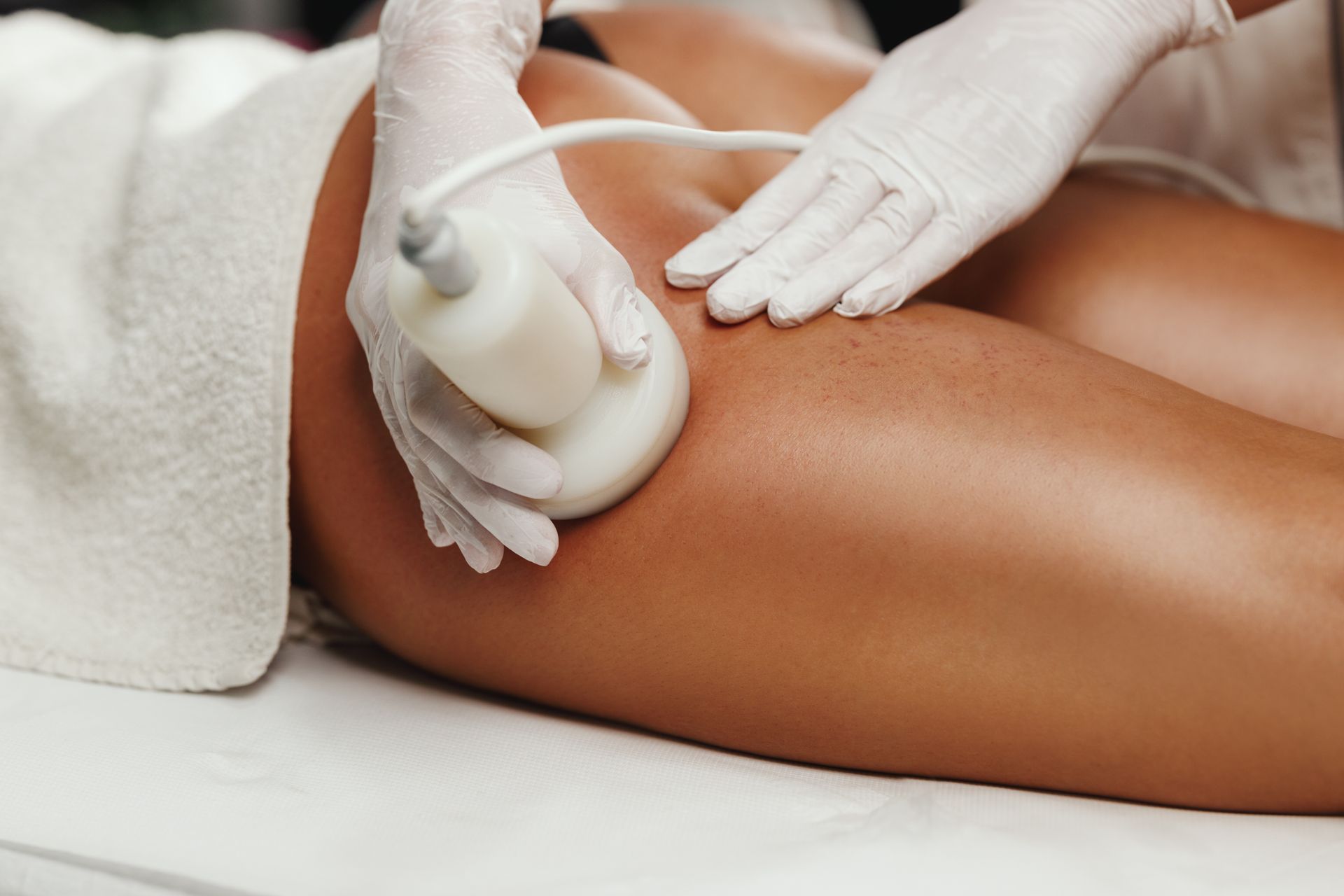 A woman is getting a cavitation treatment on her leg.