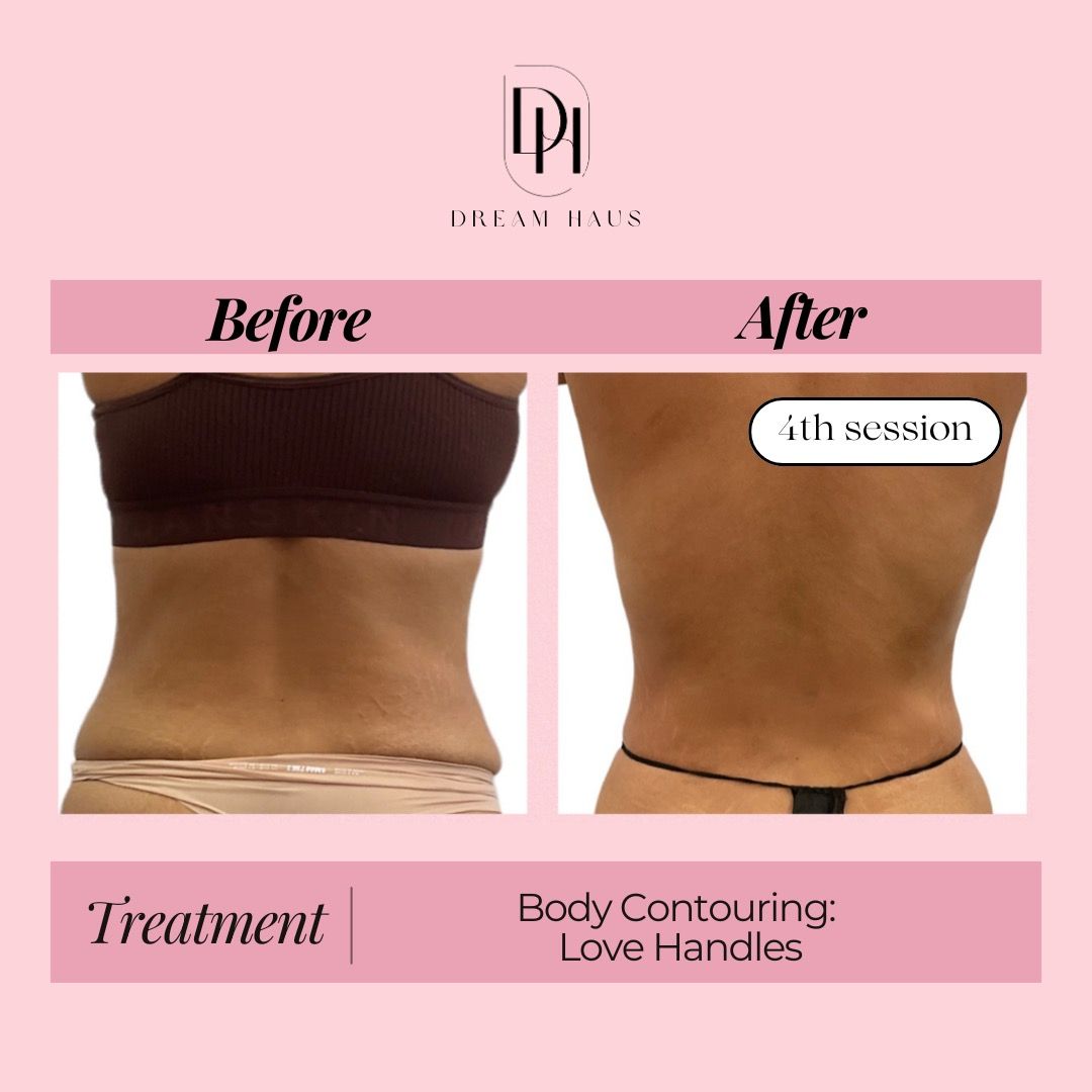 A before and after picture of a woman 's back.