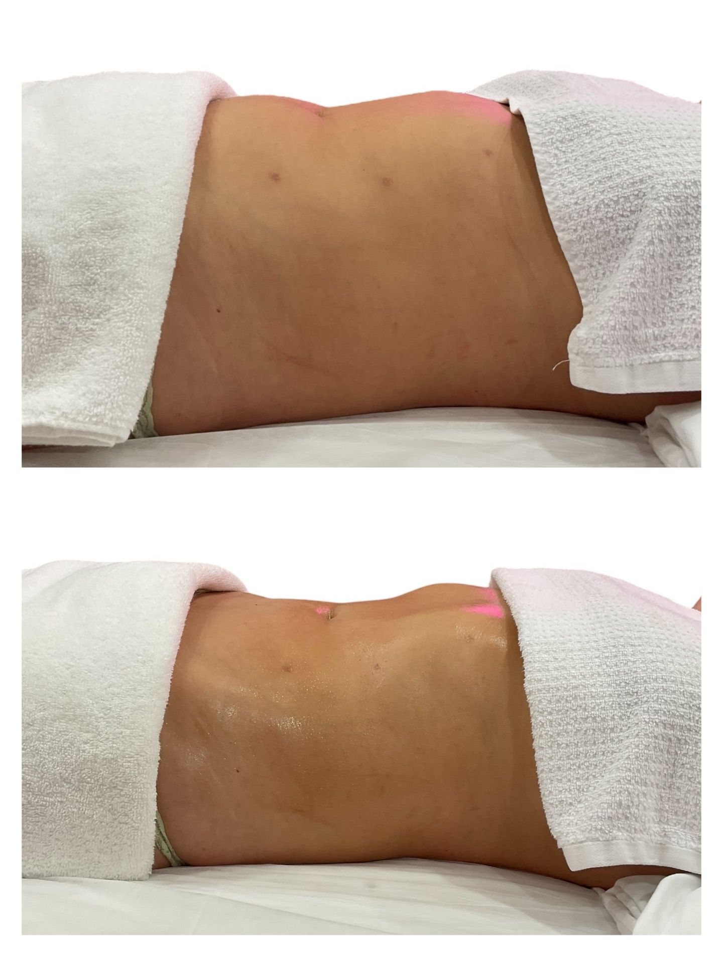 A woman is laying on a bed with a towel on her stomach.