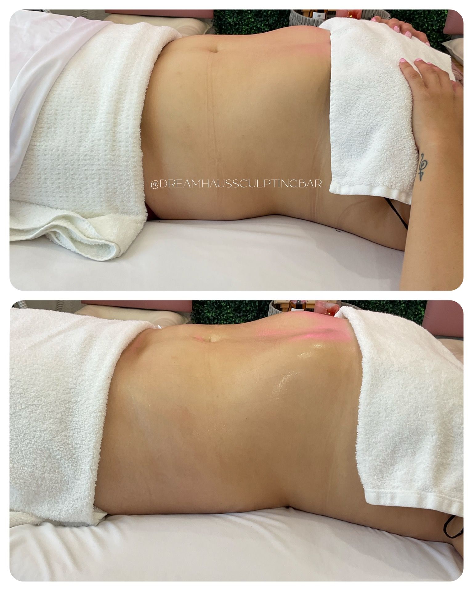 A woman laying on a bed with a towel on her stomach