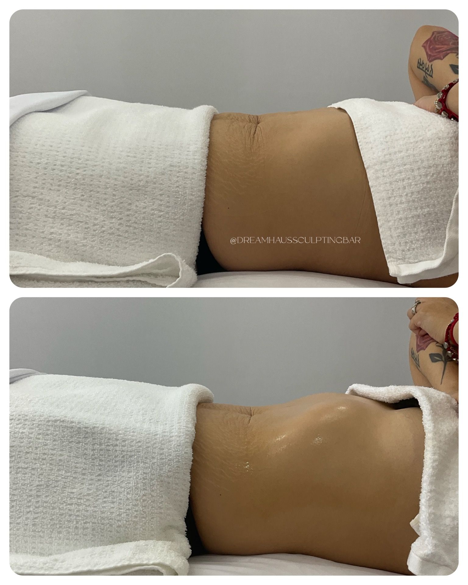 A woman is laying on a table with a towel on her stomach.