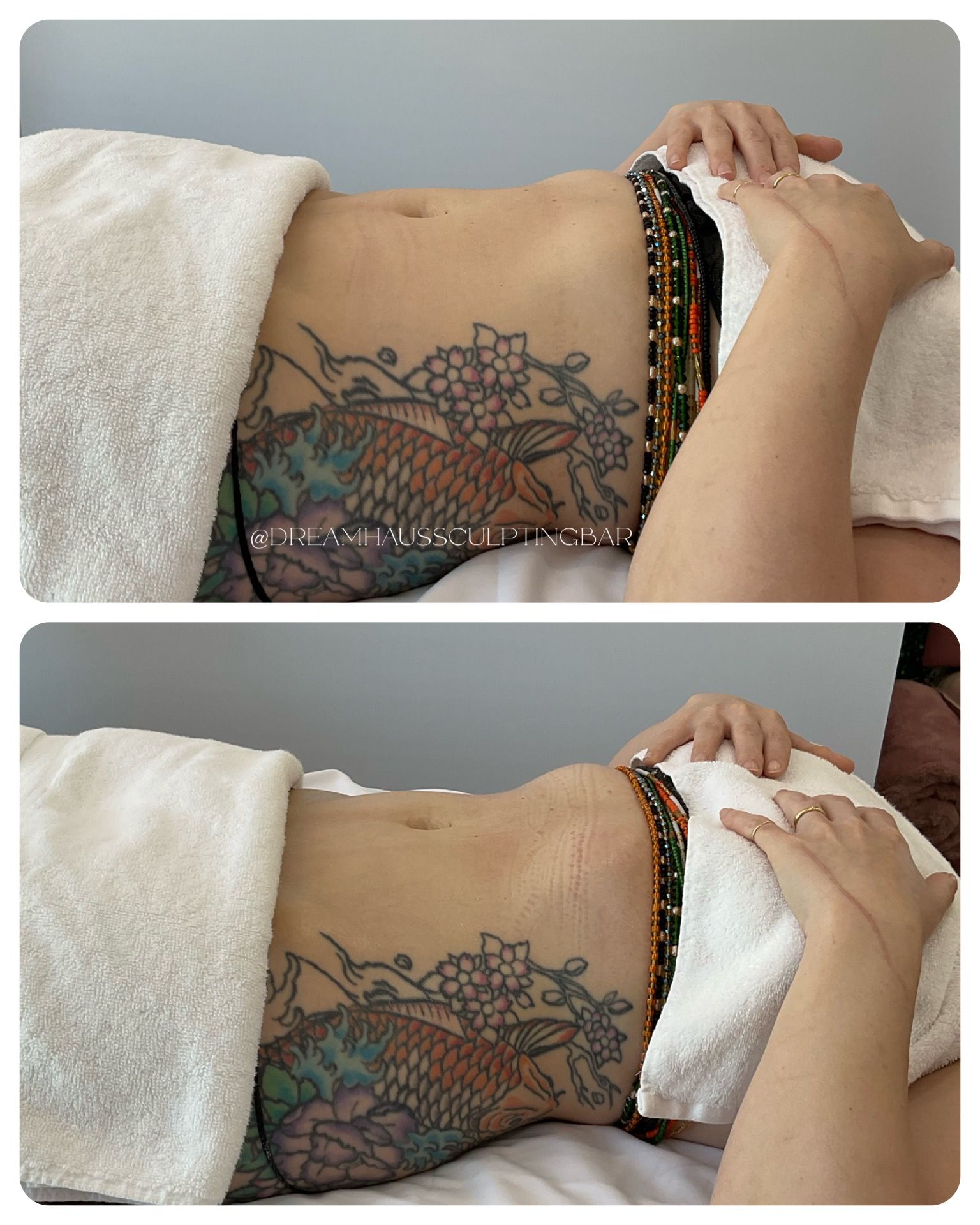 A woman with a tattoo on her stomach is getting a massage.