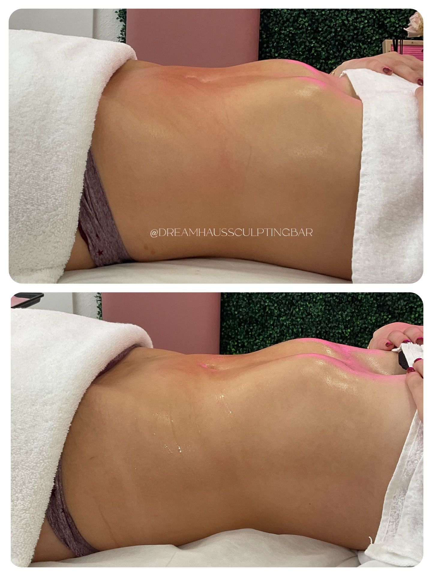 A woman is laying on a massage table with a towel around her waist.