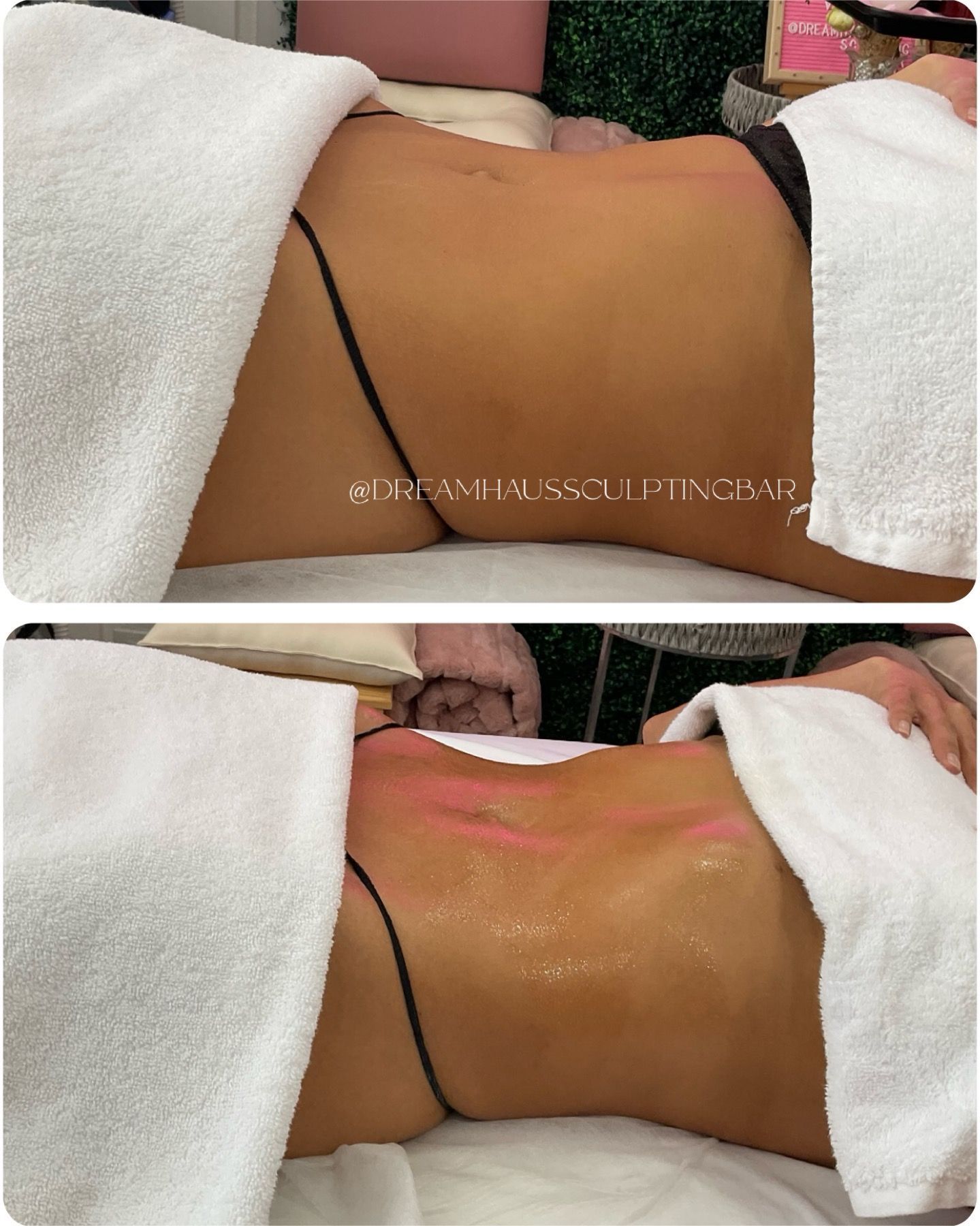 A woman is laying on a bed with a towel on her back.