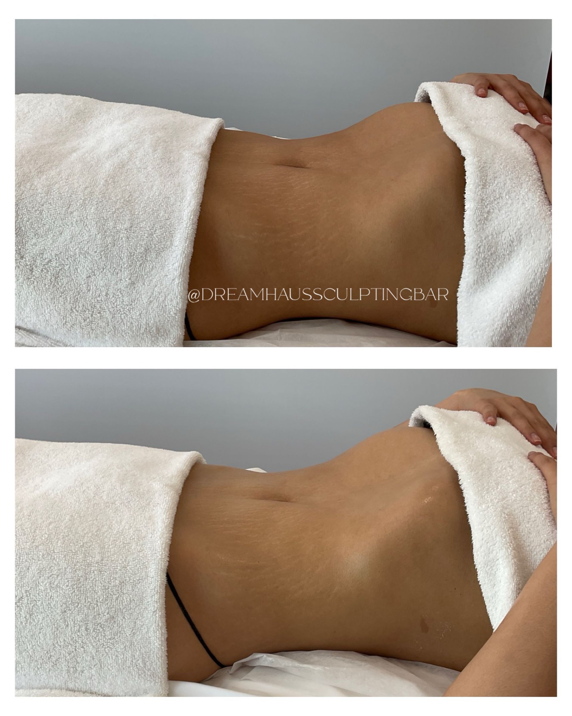 A woman wrapped in a white towel is laying on a bed