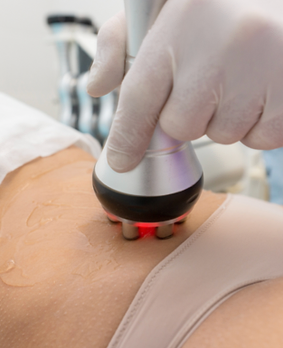 A woman is getting a cavitation treatment on her stomach.