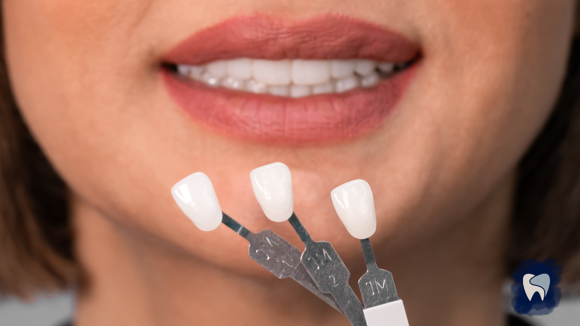 Woman smiling, holding dental shade guides next to her teeth to match the color.