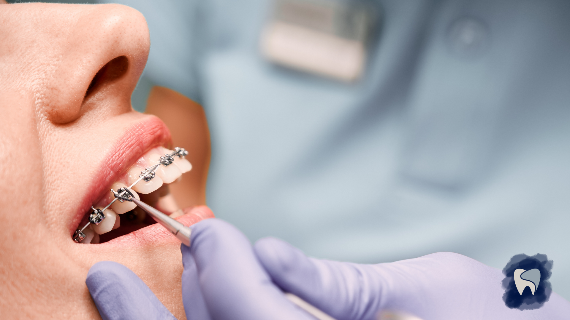 A person with braces getting dental work done. A gloved hand is using a dental tool.