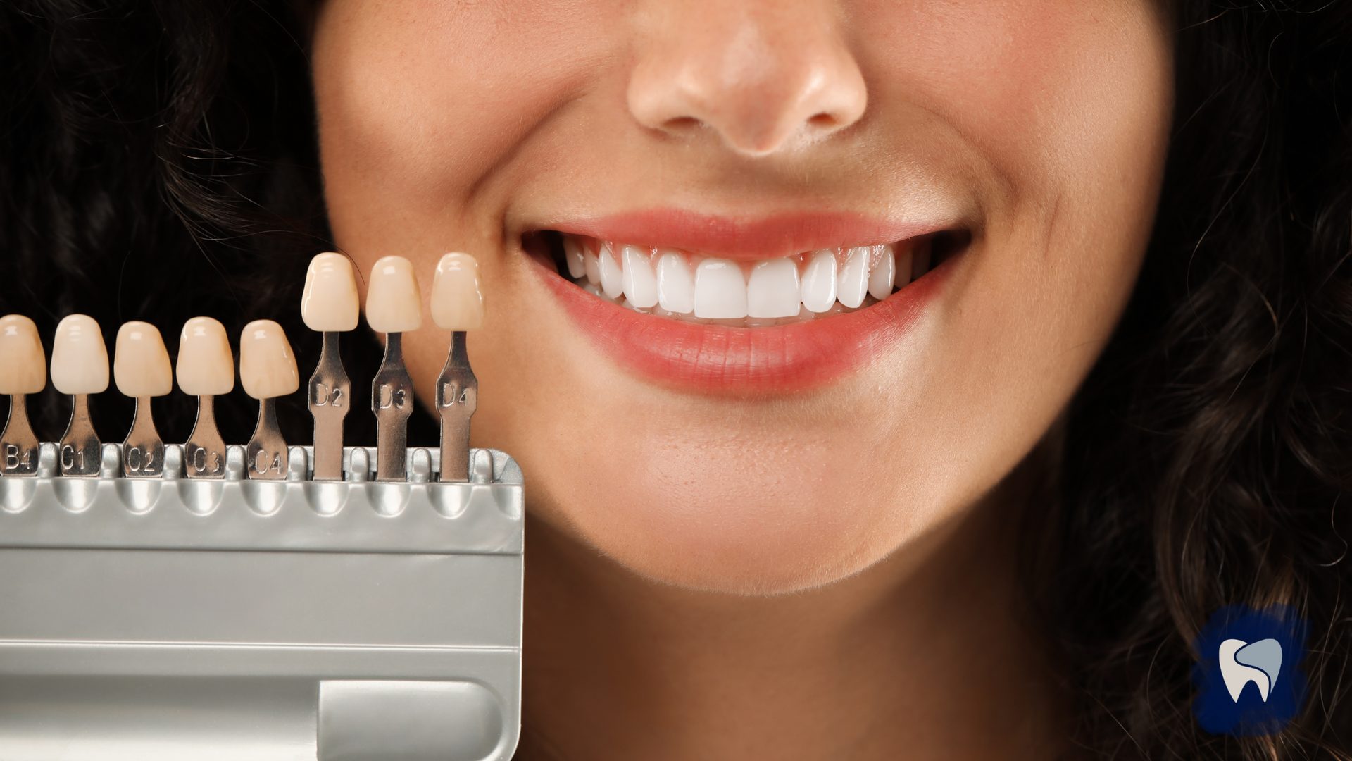 Woman smiling with a white smile, teeth shade guide in front, dental setting.