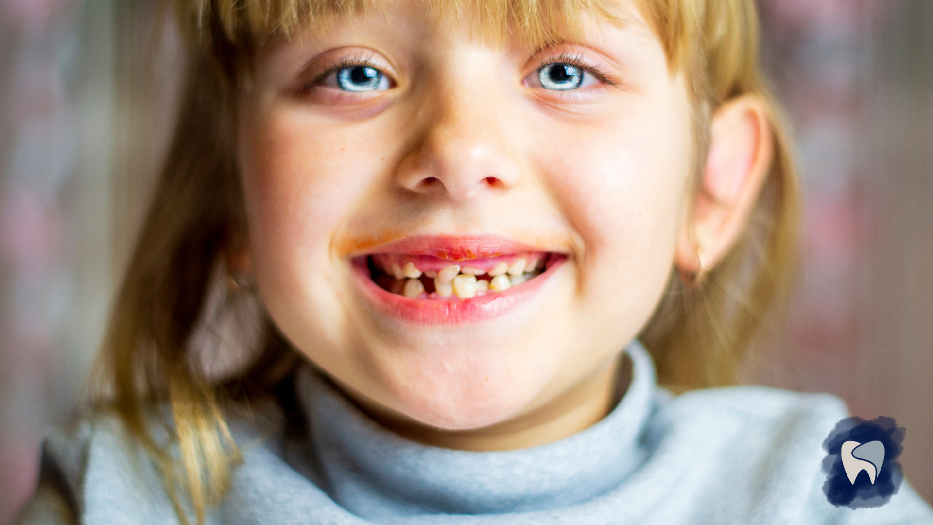 Smiling child with missing front teeth.