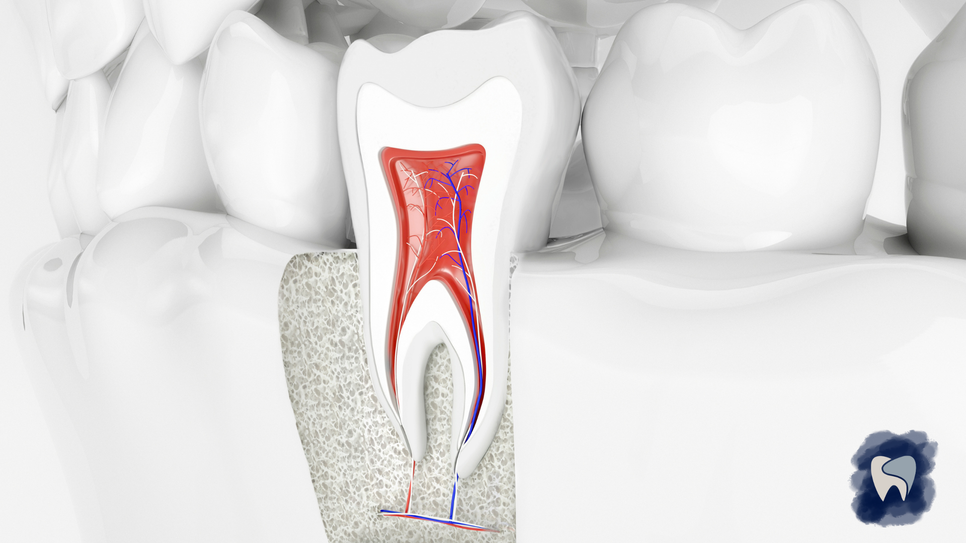 Cross-section of a molar tooth showing pulp, root canals, and surrounding bone in a dental illustration.